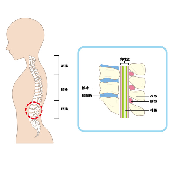 脊柱管狭窄症